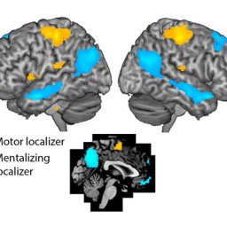 Lo que nuestro cerebro lee