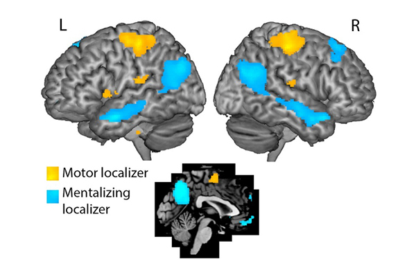 Lo que nuestro cerebro lee